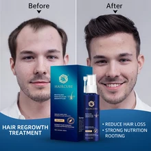 HAIRCUBE Fast Hair Growth Essence Spray Repair Scalp Frizzy Damaged Hair Care Product For Men Women Effective Anti-Hair Treatmen