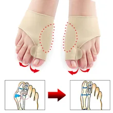 Hallux Valgus Silicone Protective Cover Toe Valgus Corrector Big Toe Valgus Fixator