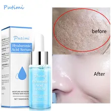 Hyaluronic Acid Moisturizing Serum Shrink Pores Oil Control Face Essence Whitening Brighten Wrinkle Remover Firming Products
