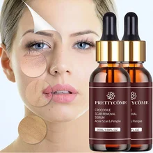 PRETTYCOME Retinol Face Serum Moisturizing Repair Skin Whiten Anti-Aging Anti-wrinkle Deep SkinCare Essence Acne Scar Removal