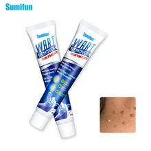 Sumifun 20g Wart Removal Body Warts Treatment Cream Skin Tag Remover Plantar Warts Ointment Chinese Herbal Medicine Plaster