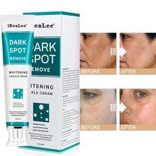 Whitening Freckle Cream Face Remove Dark Spots Melanin Melasma Remover Brightening Skin Effective Repair Anti-Aging Skin Cream